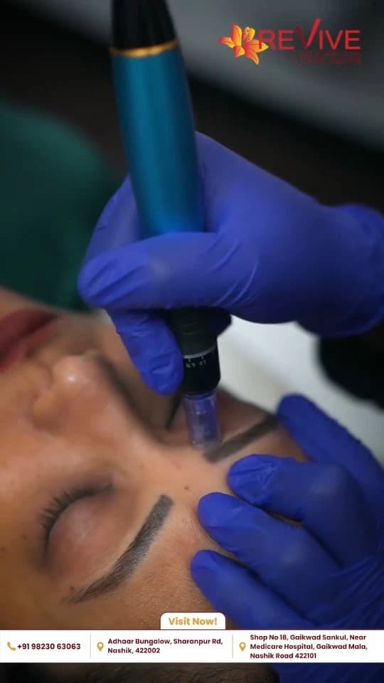 Clinical Microneedling Therapy