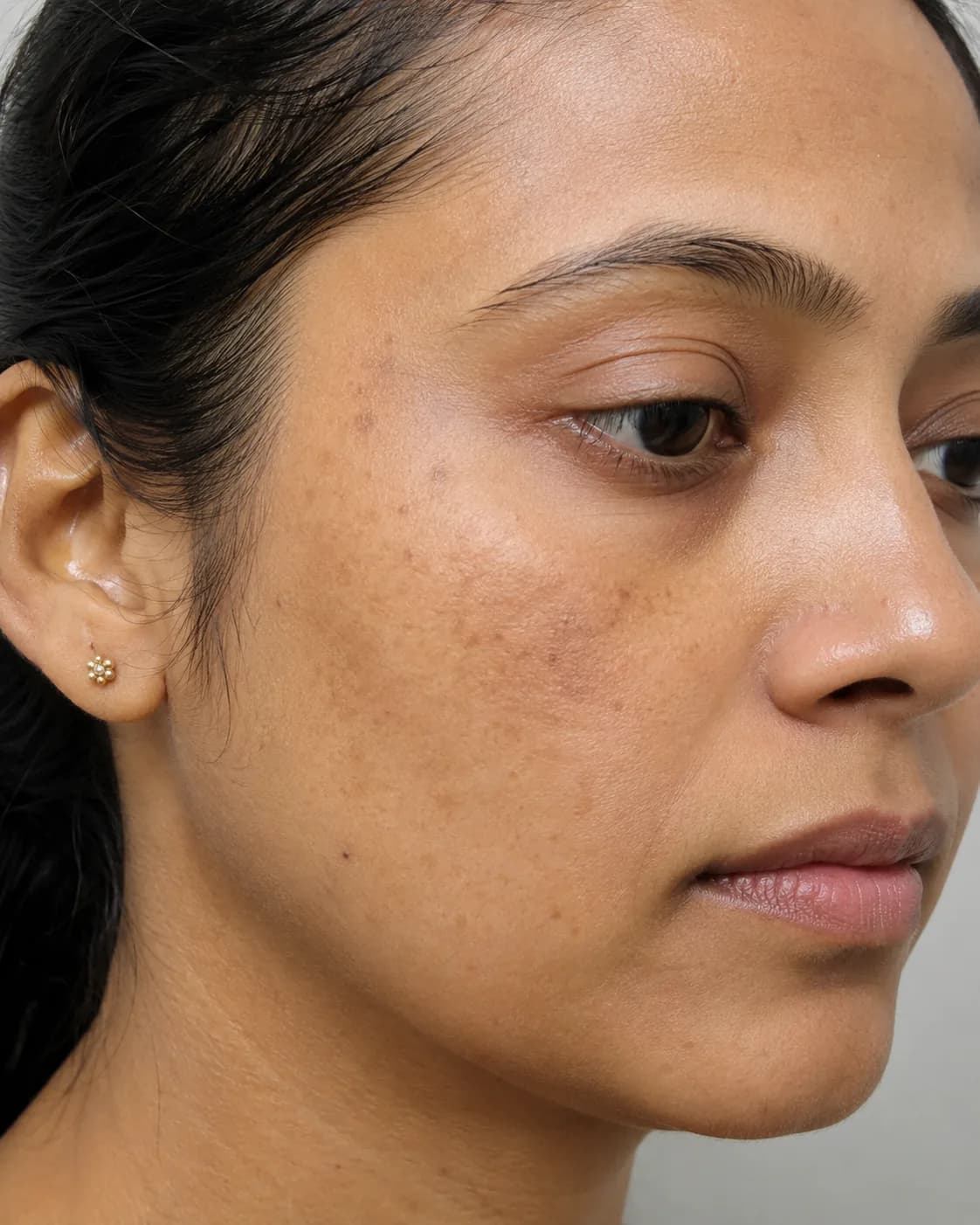 After treatment