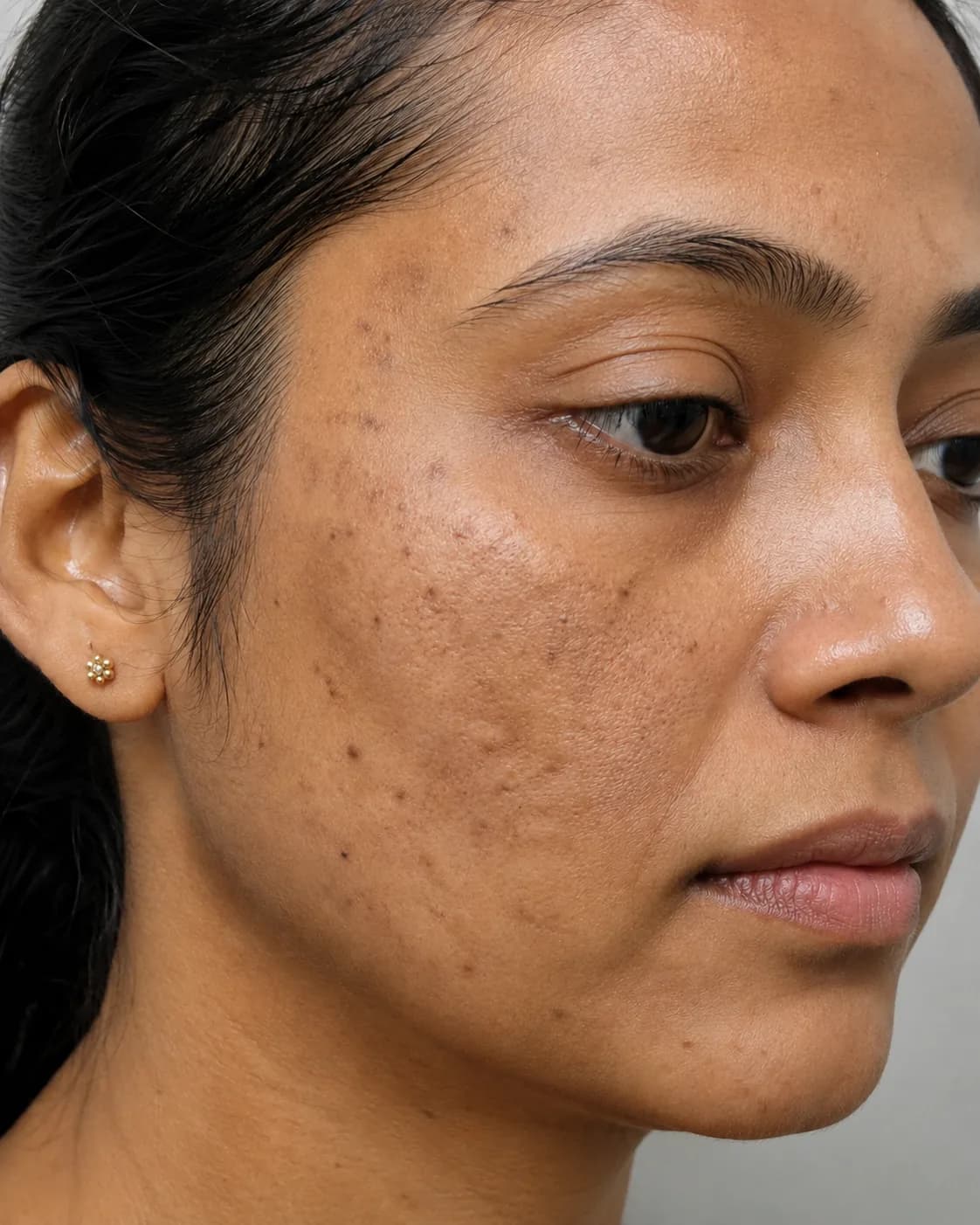 Before treatment