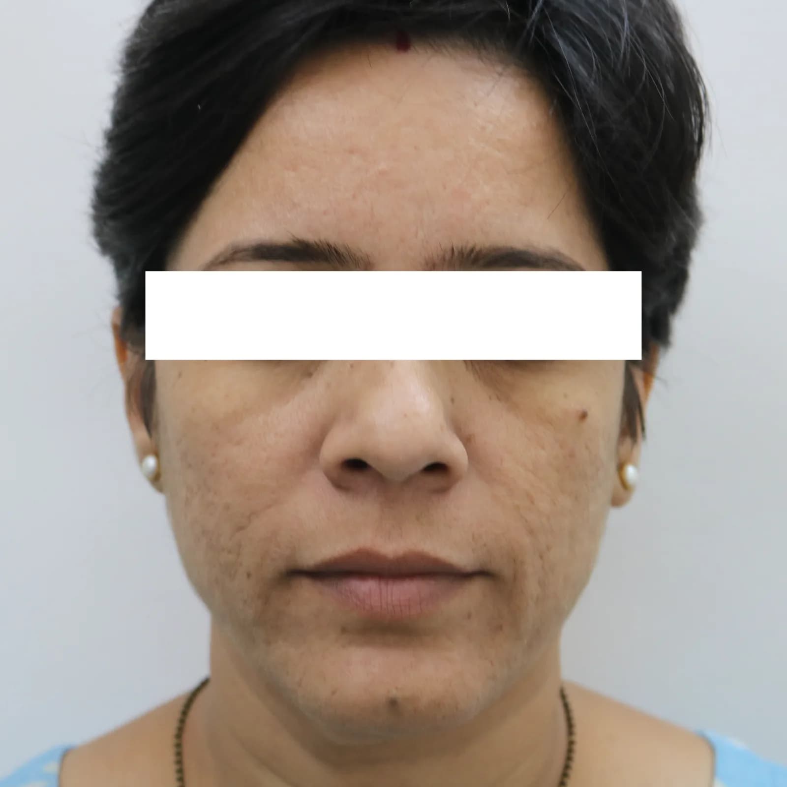 Before Microblading